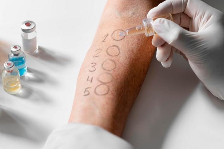Zdjęcie skórnego testu alergicznego