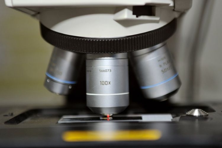 Zbliżenie na mikroskop, pod którym znajduje się preparat