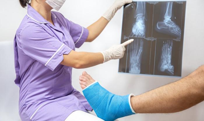 Zdjęcie przedstawiające nogę w gipsie i lekarza trzymającego zdjęcie RTG