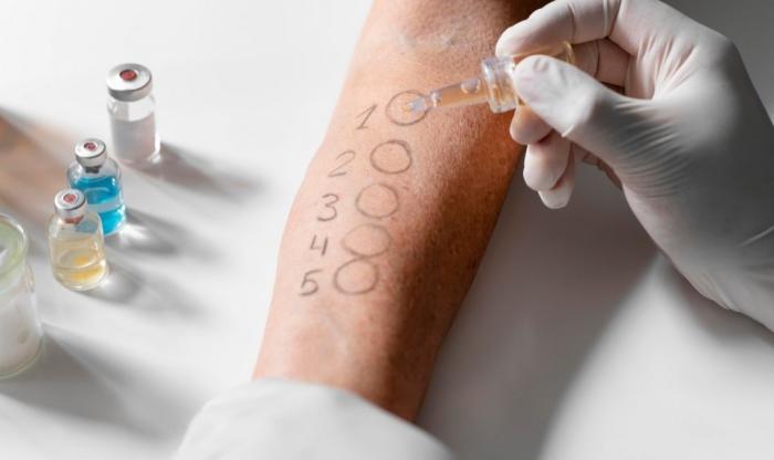 Zdjęcie skórnego testu alergicznego