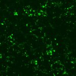 Na zdjęciu komórki HEK293T produkujące białko fuzyjne CD63-GFP (białko markerowe egzosomów CD63 z zielonym białkiem fluorescencyjnym)